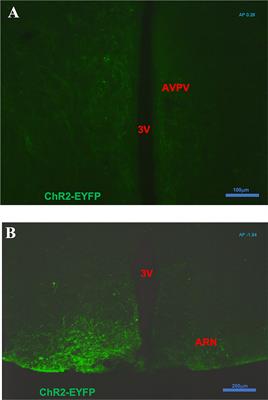 Optogenetic Activation of Arcuate Kisspeptin Neurons Generates a Luteinizing Hormone Surge-Like Secretion in an Estradiol-Dependent Manner